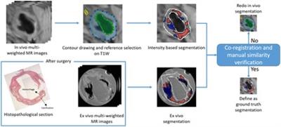 Carotid atherosclerotic plaque segmentation in multi-weighted MRI using a two-stage neural network: advantages of training with high-resolution imaging and histology